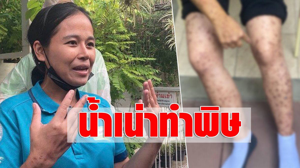 3 years wading through garbage collection, helping society, poisoning, polluted water, itchy whole body, afraid of cancer, recommends using Thai herbs to help