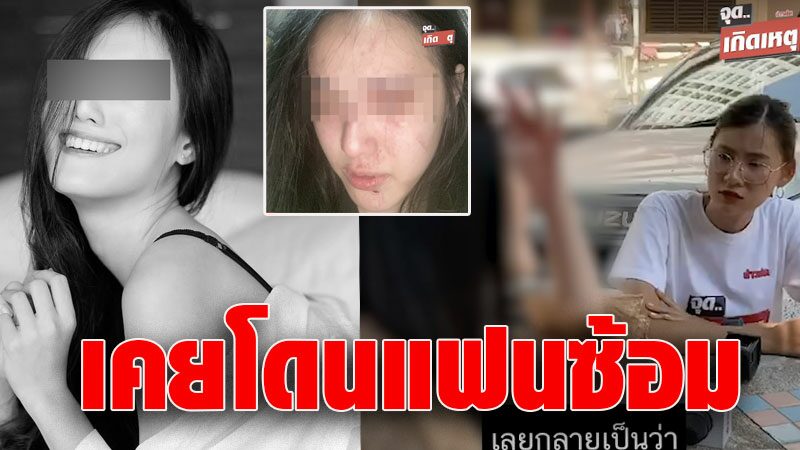 พิม เล่าถูกแฟนเก่าพระเอกMVทำร้ายสมองเคลื่อน ก่อน ทอยแทงดับ ...