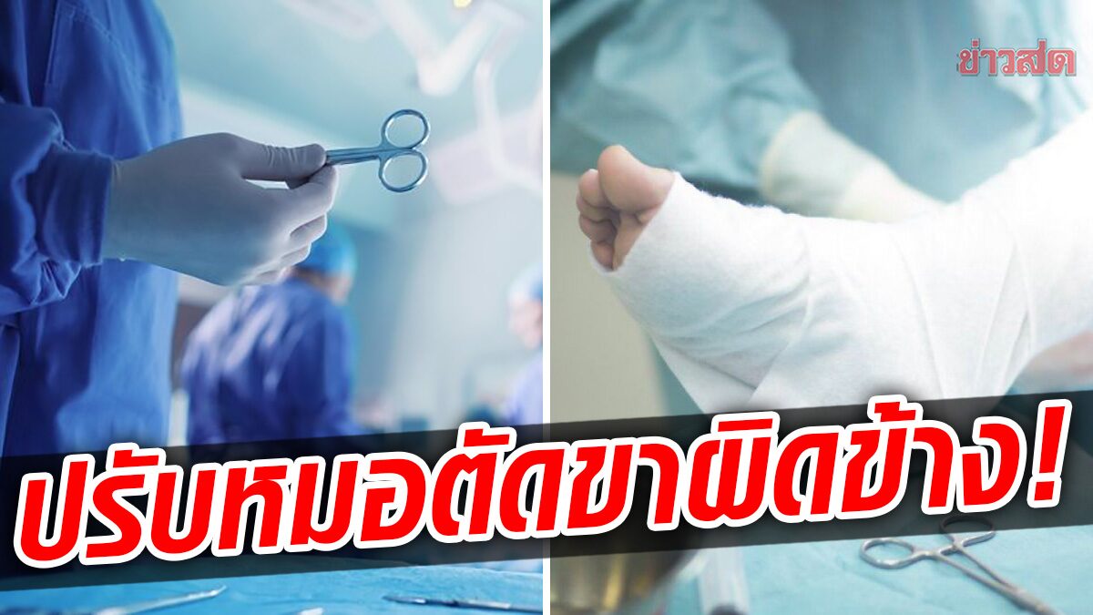 ศาลสั่งปรับหลายแสนบาท หมอออสเตรีย “ตัดขา” ผู้ป่วยผิดข้าง!