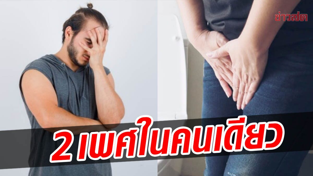 สุดช็อก! ชายขาหนีบบวมนาน 10 ปี คิดว่าเป็นไส้เลื่อน พบรังไข่-มดลูกแทนอัณฑะ