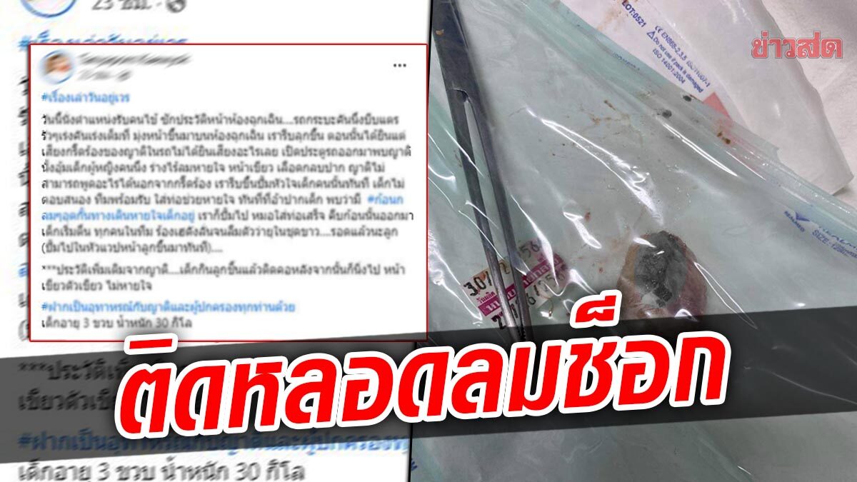 อุทาหรณ์ เด็ก 3 ขวบ สำลักลูกชิ้น ติดหลอดลม ช็อกลำตัวเขียว ปั๊มหัวใจยื้อชีวิต