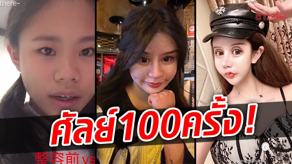 เน็ตไอดอลสาววัย 18 เสพติดศัลยกรรม ใน 5 ปี ทำมาแล้ว 100ครั้ง!