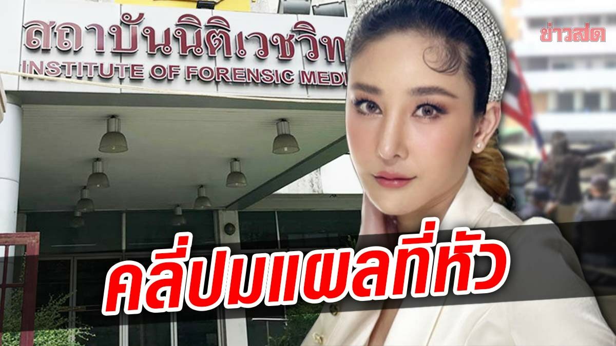 ผู้การนิติเวช เตรียมเรียกแพทย์ชันสูตรให้ข้อมูล หลังชาวเน็ตสงสัยแผลบนหัวแตงโม