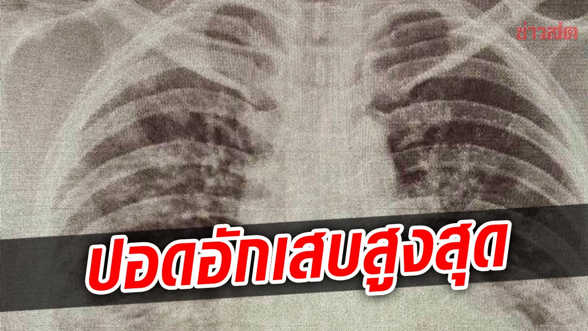 เผย กทม. สมุทรปราการ โคราช พบผู้ป่วยโควิด ปอดอักเสบ ติดเชื้อสูงสุด