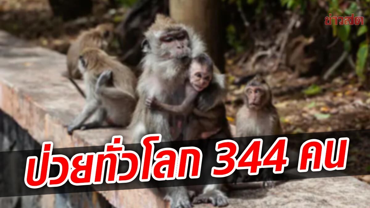 ทั่วโลกป่วย ฝีดาษลิง 344 ราย สเปนมากสุด ส่วนใหญ่เป็นชาย ไทยยังไม่มี