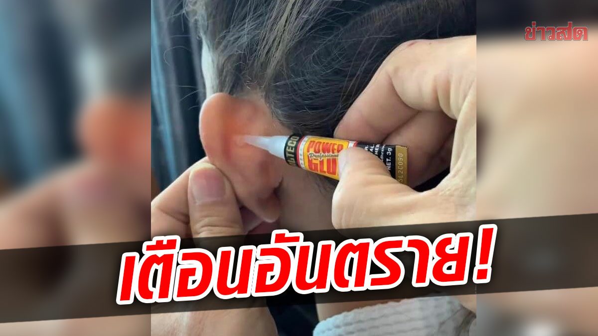 อย่าหาทำ! ช่างเสริมสวยใช้กาวตราช้าง ติดหลังใบหู-แก้หูกาง เตือนอันตราย