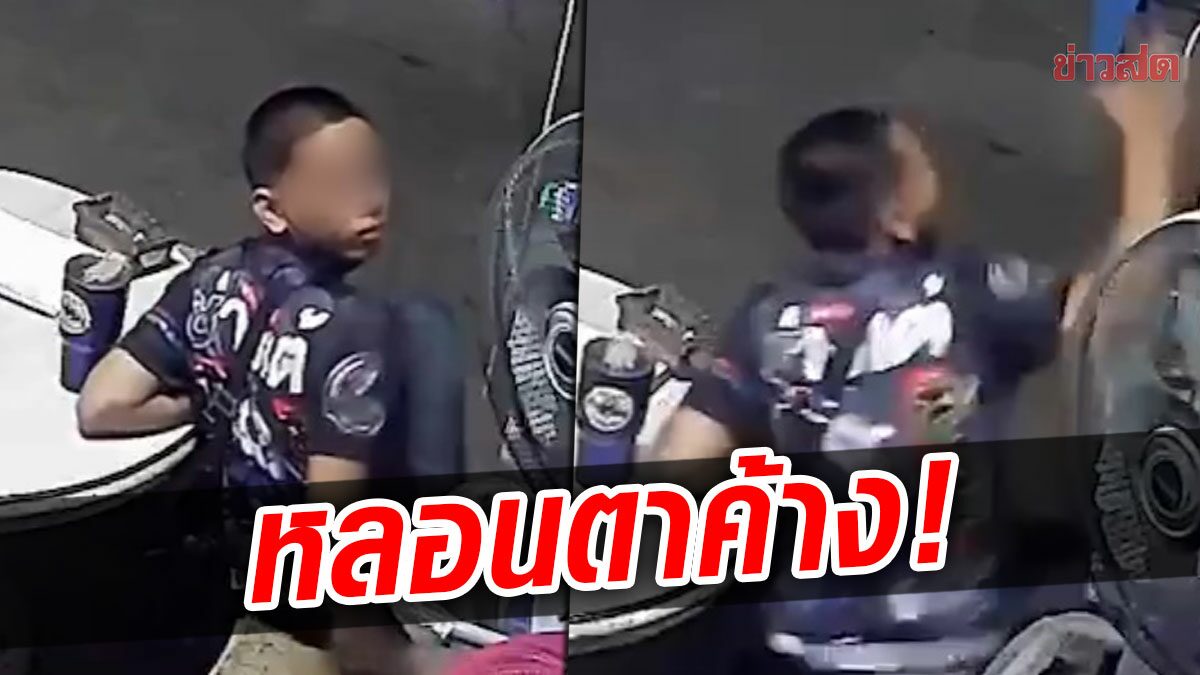 สุดหลอน! หนุ่มหันมองวงจรปิด-ช็อกตาค้าง หมอตรวจแล้วเผยสาเหตุ (คลิป)