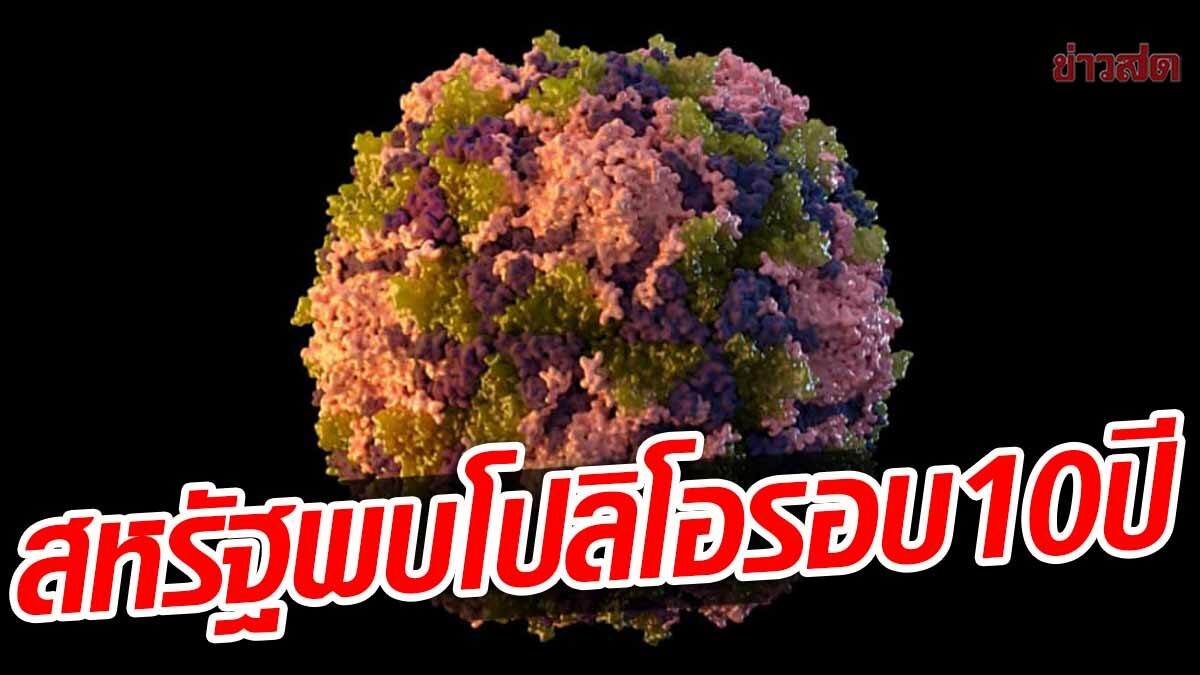 สหรัฐ พบผู้ป่วยโปลิโอรายแรก ในรอบเกือบ 10 ปี