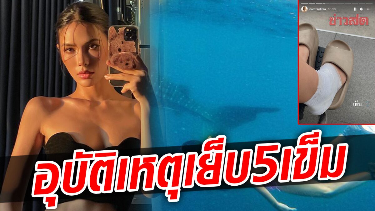 สปิริตนางแบบ “น้ำตาล ชลิตา” เกิดอุบัติเหตุที่เท้า แต่สู้ถ่ายงานต่อ สุดท้ายเย็บ5เข็ม