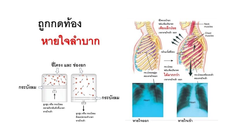 หมอ เผย สาเหตุหายใจลำบาก คนใส่สเตย์รัดหน้าท้องบางคนหน้ามืดเป็นลม ชี้ การกดแน่นที่ท้องมีผลกับ การหายใจด้วย