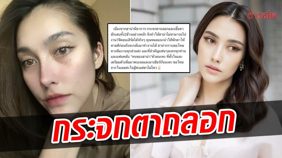 ฮาน่า กระจกตาถลอก-เยื่อตาอักเสบ หมอสั่งพักงาน ขอโทษแฟนๆ ที่ไปเจอไม่ได้