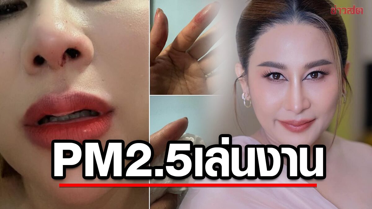 เตือนระวัง! "ลาล่า" เลือดกำเดาแตก โดนฝุ่น pm2.5 เล่นงานเข้าเต็มๆ